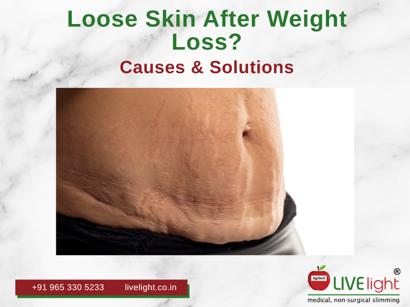 Loose Skin After Weight Loss: Causes, Solutions and How Body Contouring Treatment in Mumbai Can Help