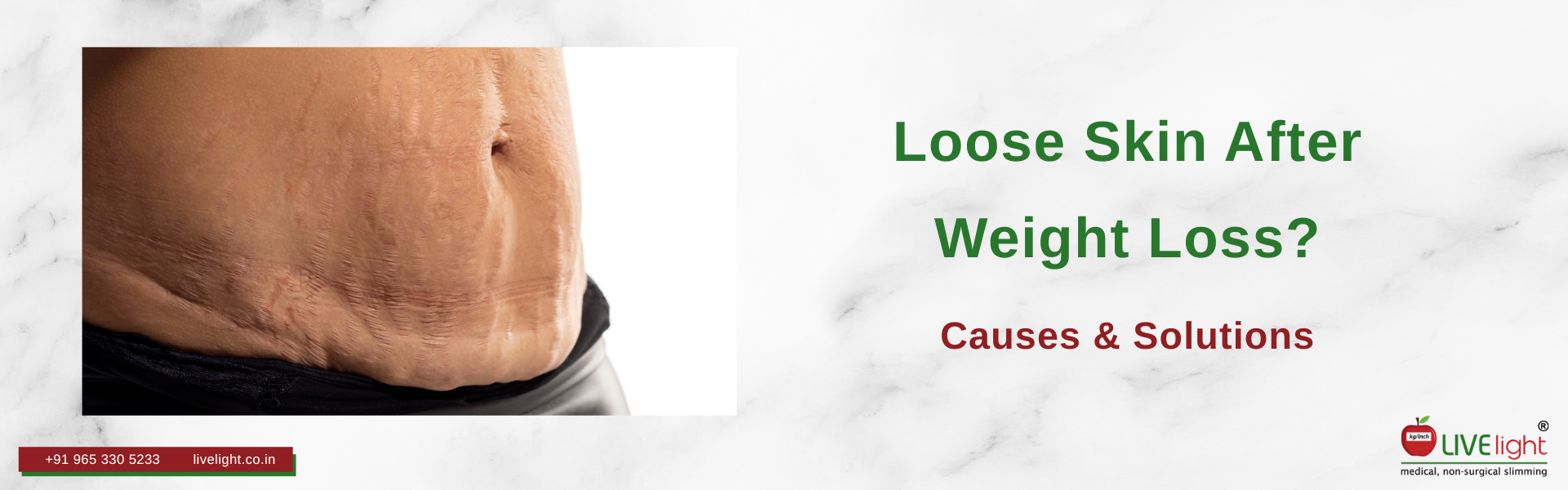 Loose Skin After Weight Loss