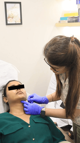 Thread lift treatment procedure at livelight Thane